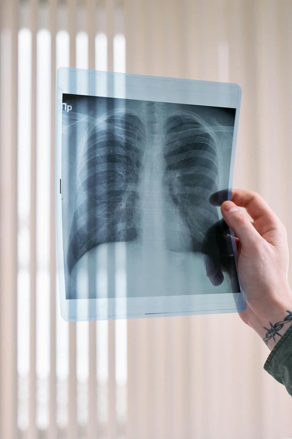 Preoperative Pulmonary Evaluations